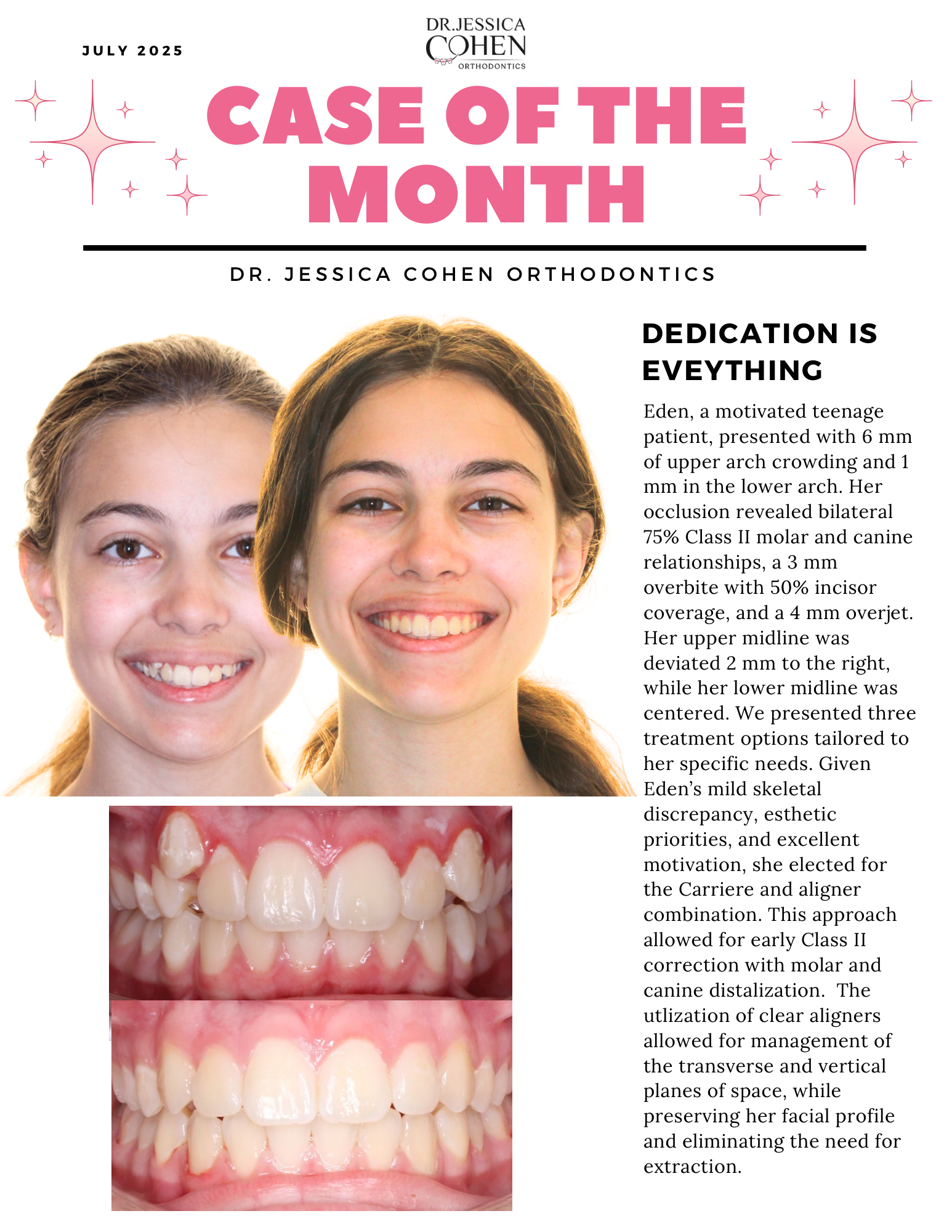 Cover of newsletter titled How to Choose a Teeth Whitening System