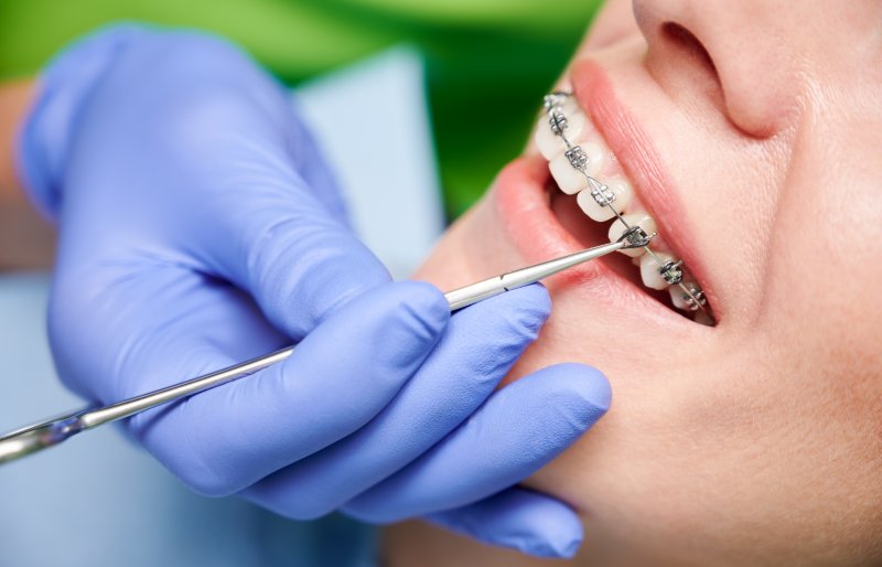 An orthodontist placing braces on a patient’s teeth