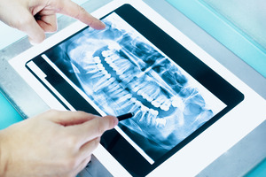 Looking at a dental X-ray on a tablet